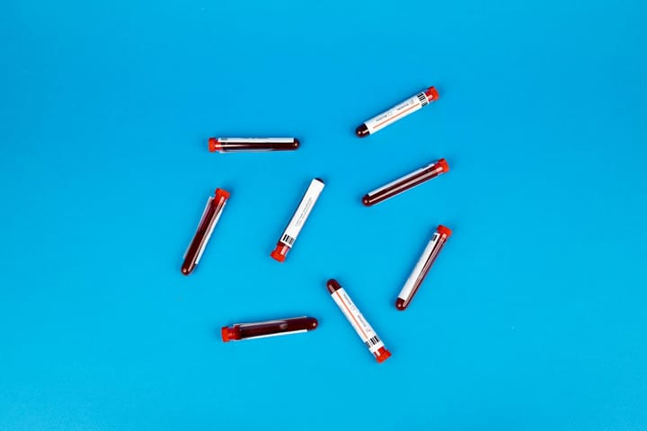 blood test with fasting